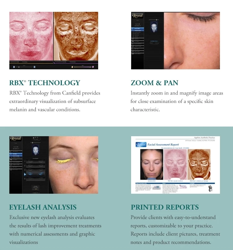 3d Observe Facial Analyzer: Reveal Detector Skin Analysis Machine