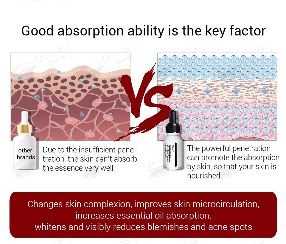 rosehip oil pregnancy