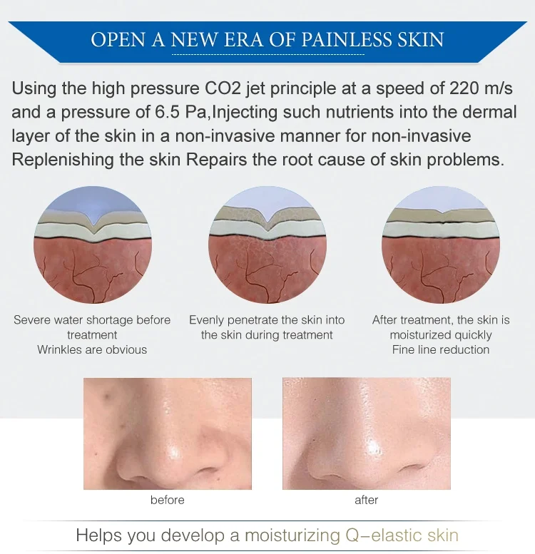No needle mesotherapy anti-aging skin whitening rejuvenation frozen skin gun