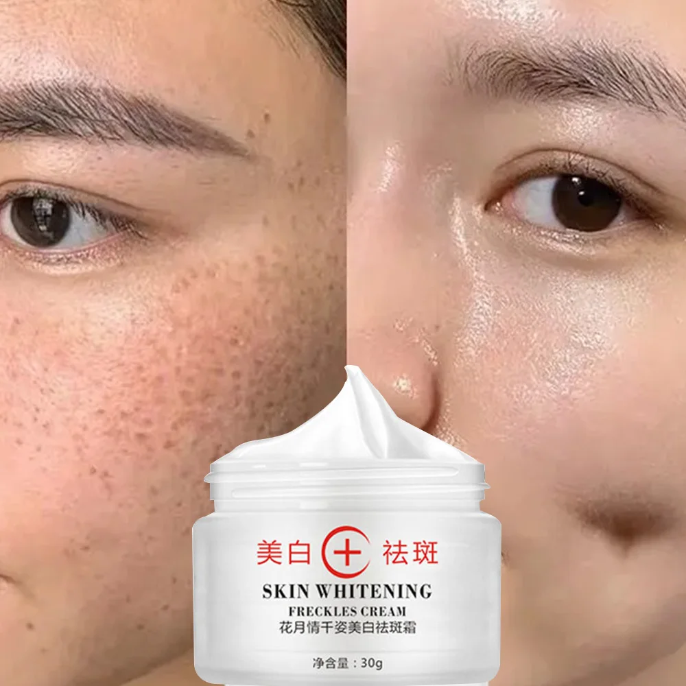 

Arbutin Cream Skin Whitening Face Dark Spot Removal Best Whitening Cream For African Skin