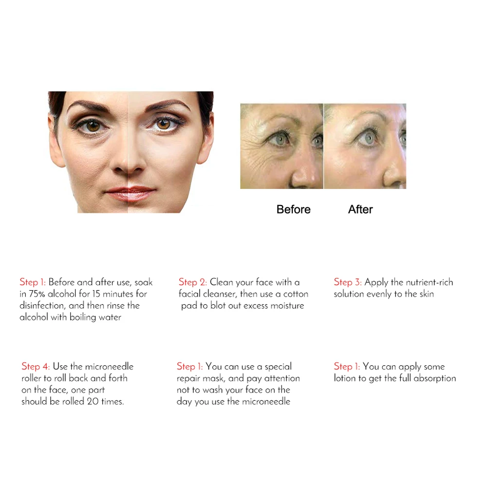 Safer Stamp Derma Recovery Skin Care Adjustable 140 Pins Stamp Drs Microneedle Derma Roller Therapy For Skin Care Machine Buy Derma Stamp Derma Pen Con Mesoterapia Micro Needle Pen Product On Alibaba Com
