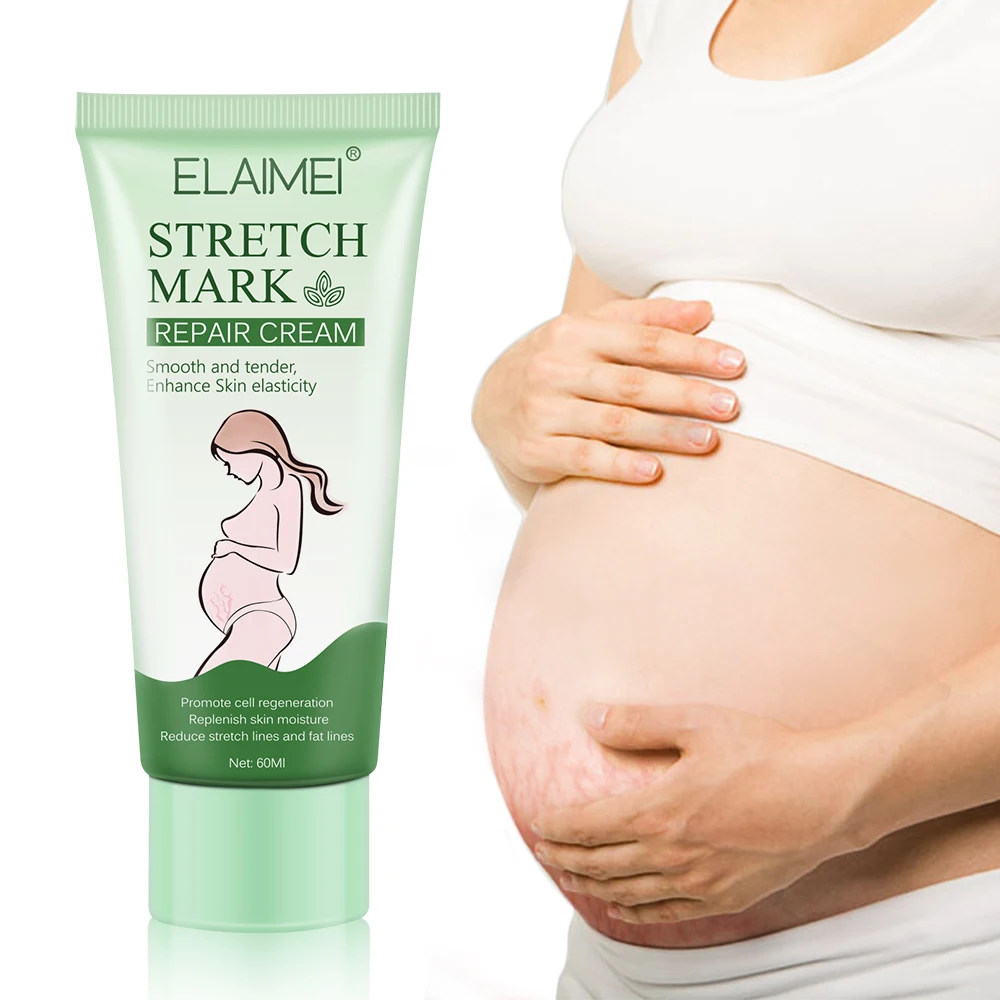 

Natural Herbal Stretch Marks Cream Remove Stretch Marks Fade Scars Moisturizing Whitening Stretch Marks Removal Cream