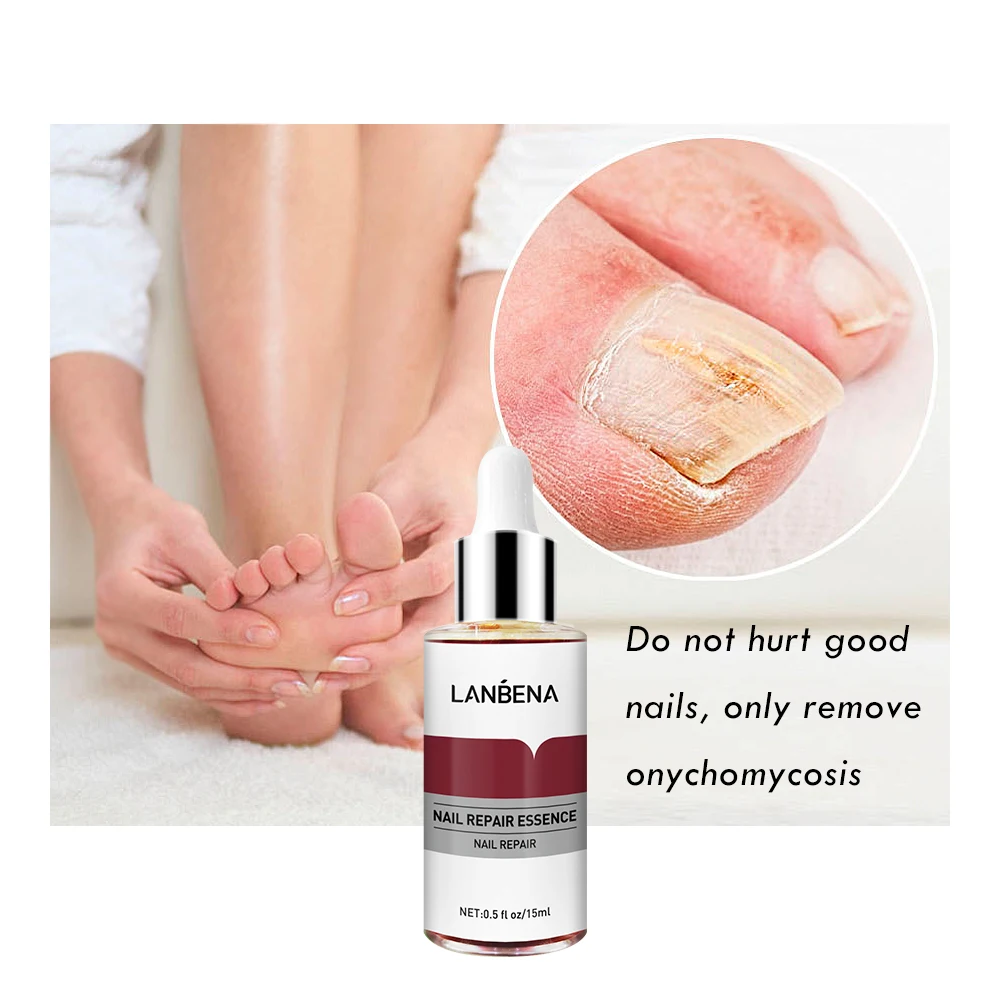 

LNBENA skin and nail care to remove onychomycosis toe nourish and brighten hands and feet skin care nail repair essence