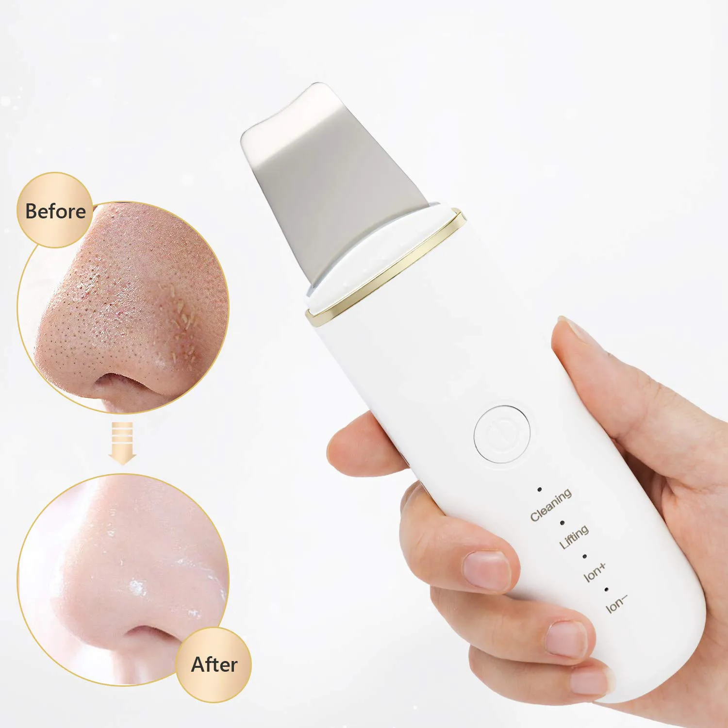 

Portable Ultrasonic Beauty Personal Care Acne Pore Beauty Equipment Facial Cleaner Dermabrasion Ion Ultrasonic Skin Scrubber, White