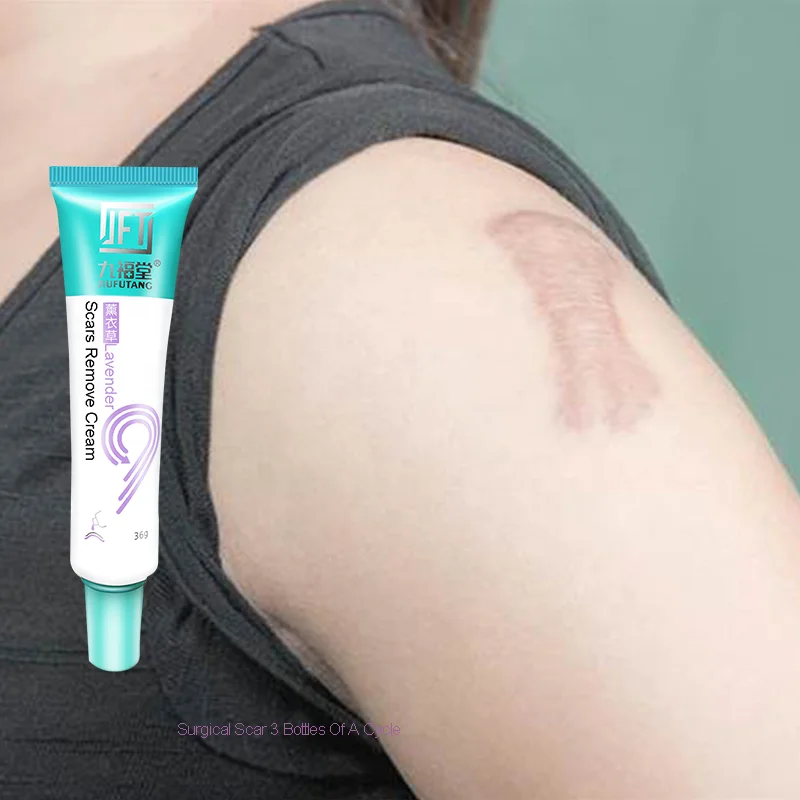 

scar remover for old scars home remedies ph remove scar tissue under skin