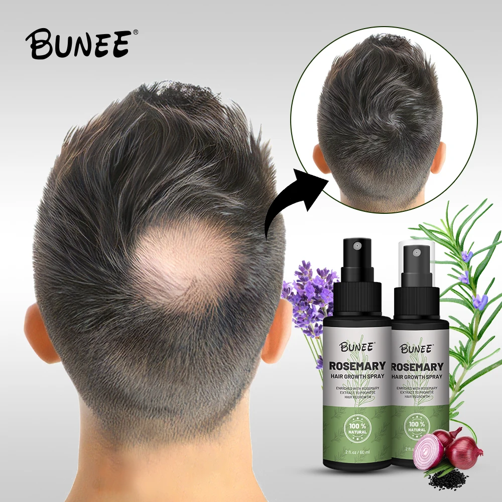 

Factory Directly Best Effect Hair Care Rosemary Growth Oil Serum Hair Treatment Hair Growth Spray 60ml