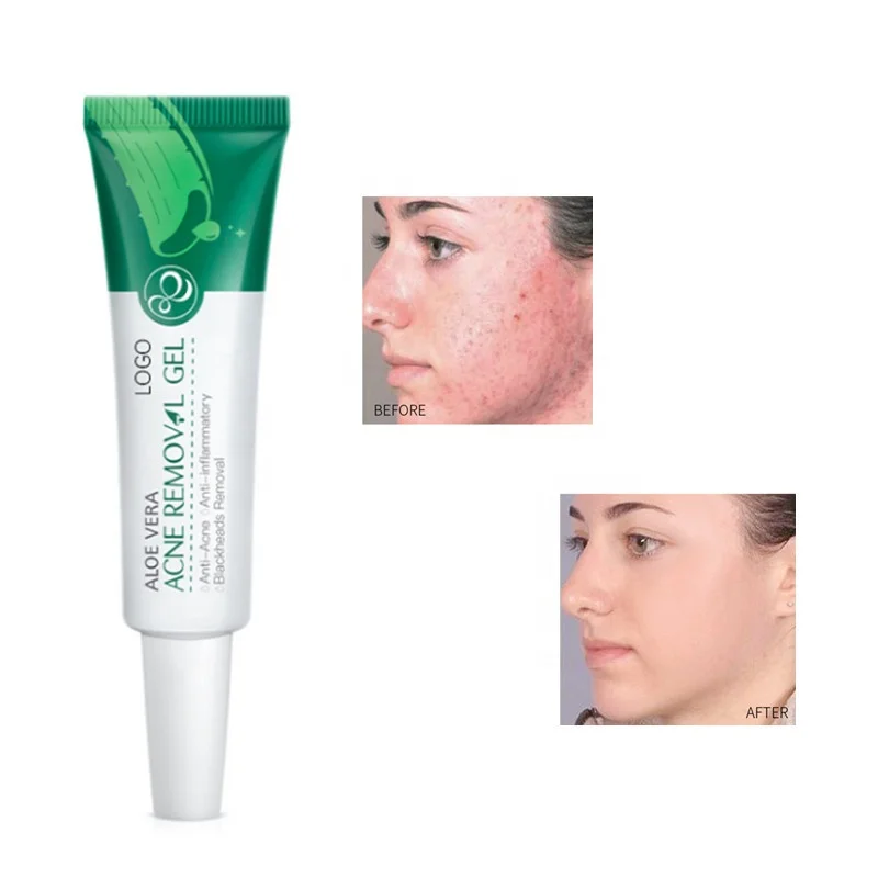 

OEM Skin Care Organic Pure Natural 100% Aloe Vera Gel Anti Acne Whitening Moisturizing Aloe Vera Cream, Transparent