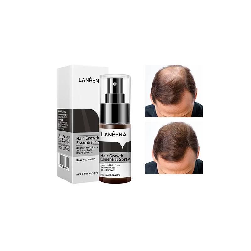 

LANBENA anti hair loss treatment spray hair regrowth spray