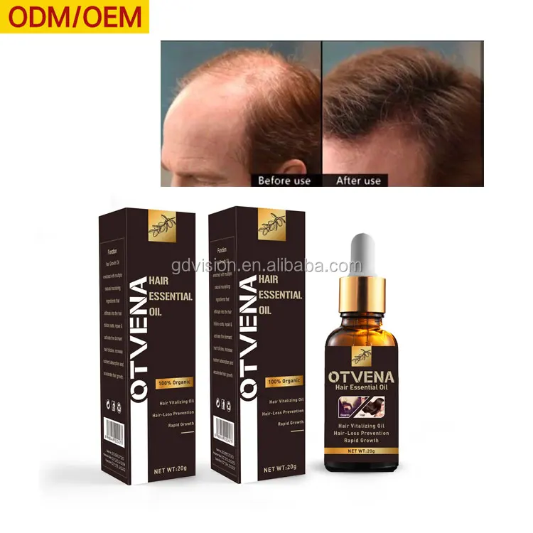 

Support Maximized Hair Growth From Inside Out Fast Effect Men Hair Growth Oil