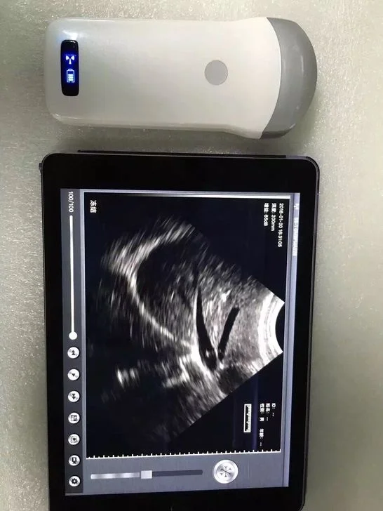 mindray veterinary ultrasound