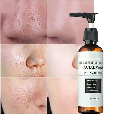 

OEM Private Label Natural Organic Oil Control Anti Acne Tea Tree Face Wash