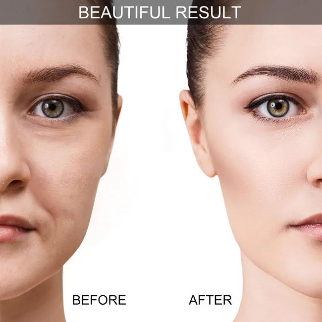 
Face and Eye 6 Pieces Facial Massage Cupping Therapy Set with Exfoliating Brush for Neck Skin Anti-Wrinkle Effect 