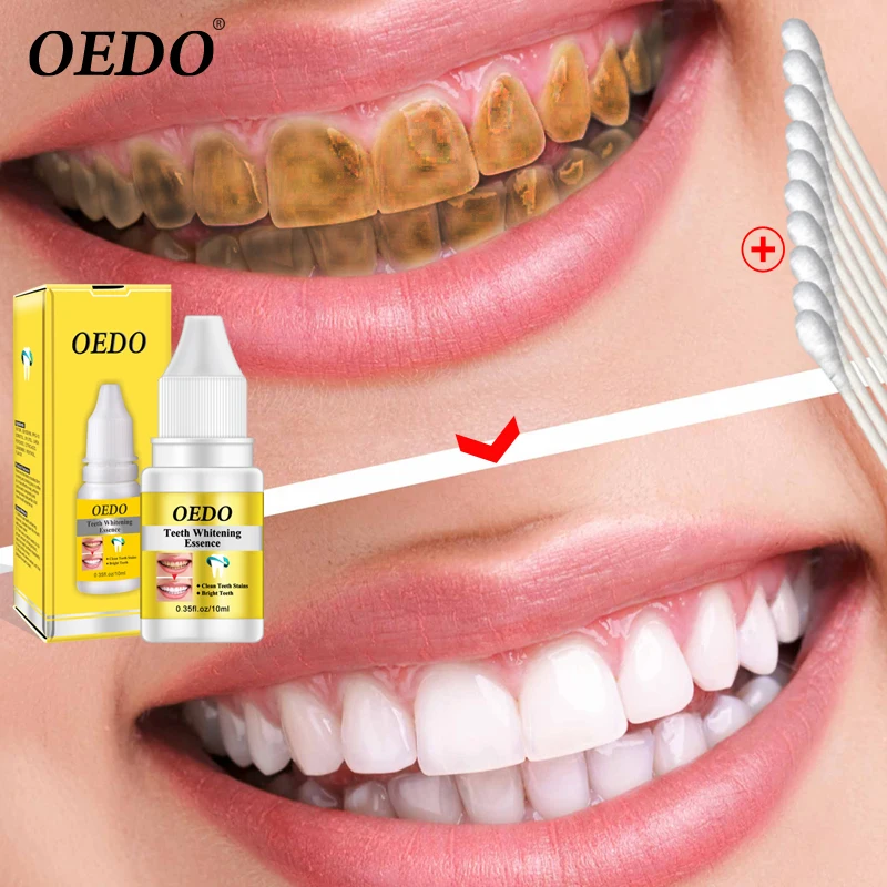 

OEDO Teeth Wash Serum Personal Oral Hygiene Remove Plaque Stains Whitening Bleaching Teeth Cleaning Liquid, Transparent