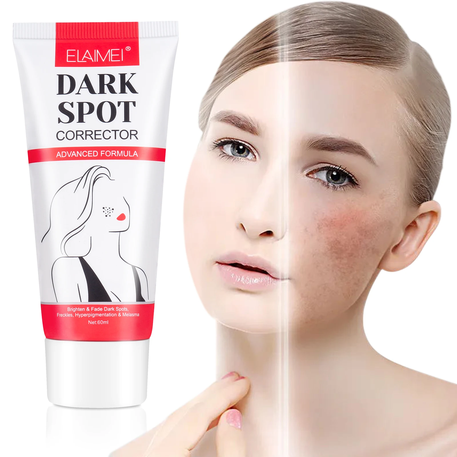 

Elaimei Dark Spot Corrector for Face Fade Out The Skin Black Precipitate Remove Freckle for Face Fade Spots Natural Ingredient