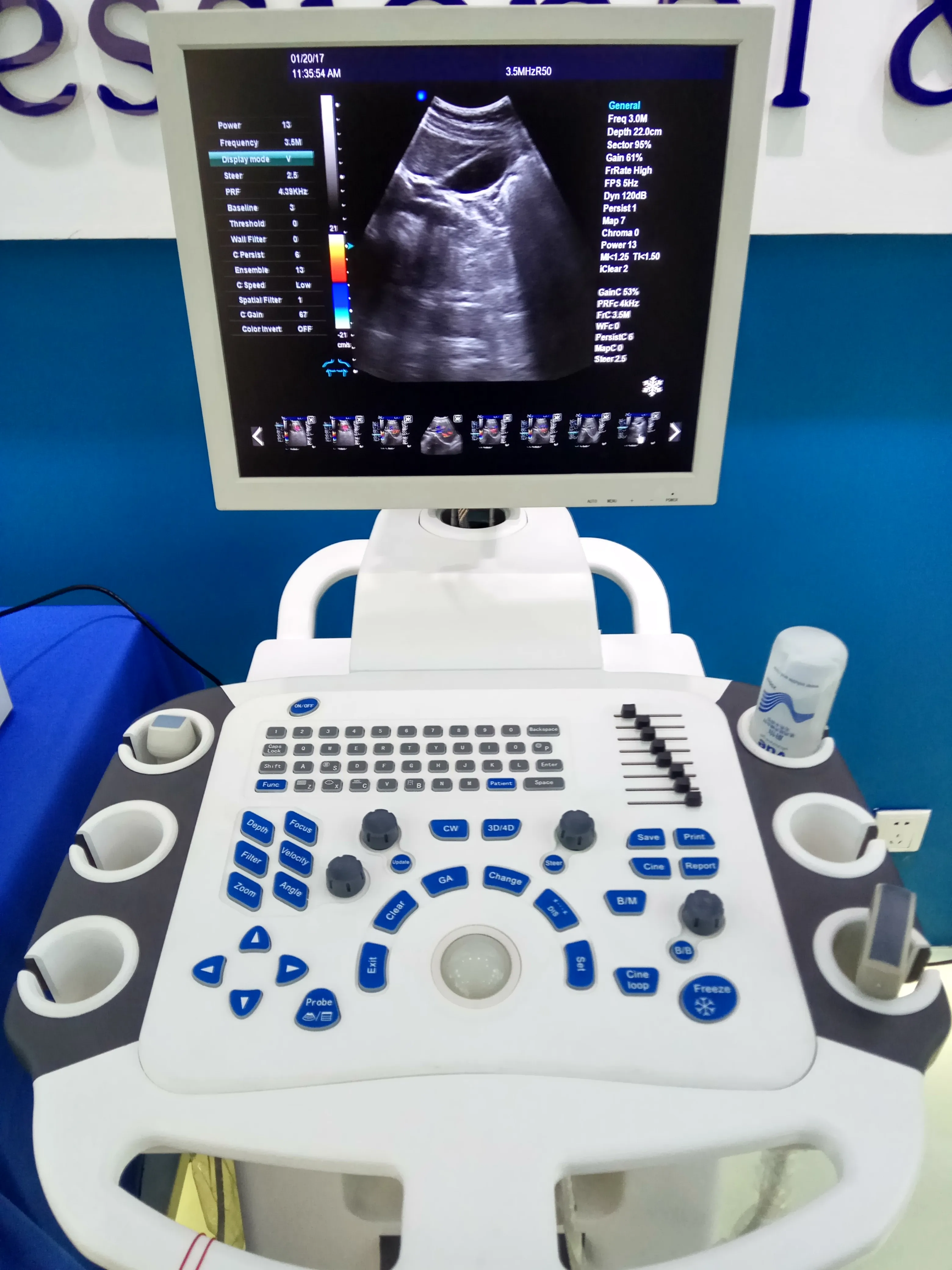 2017 New Design Ultrasonic Diagnostic Instrument With Ce Certification