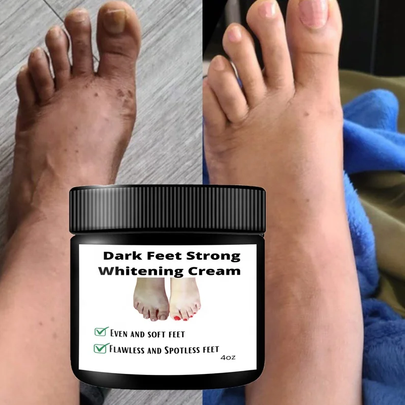 

Dark Feet Whitening Cream Fast Action Extreme Whitening Cream for Dark Feet