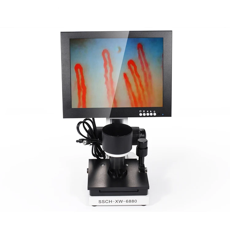 

electron microscope/ LCD Digital Microscope Microcirculation/Blood Capillary Microscopes