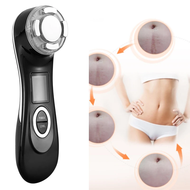 

Japan stretch mark machine laser treatment stretch marks removal for women home use, White, pink, black