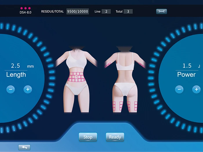 2 in 1 Face Lift Hifu Machine Vaginal Tightening Machine with 5 Hifu Cartridge