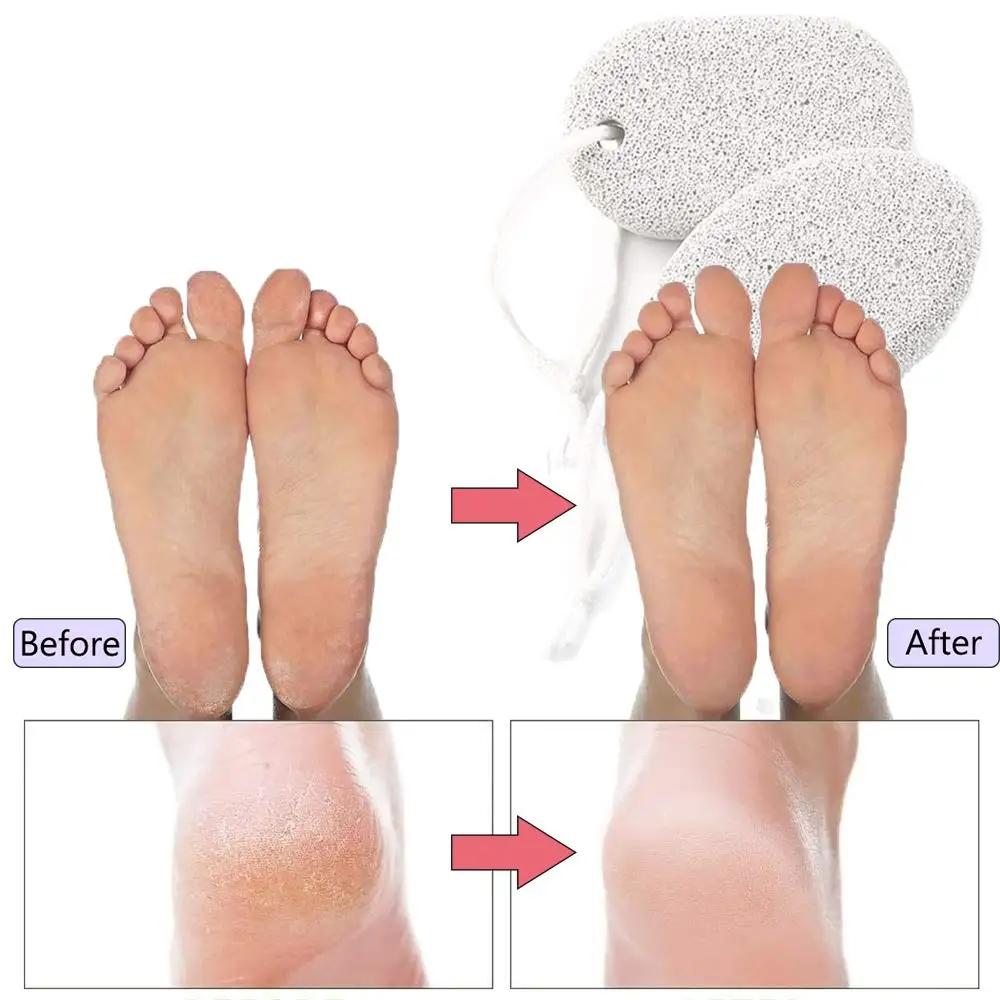 New Product 100 Natural Exfoliating Volcanicl Lava Foot Pumice Stone