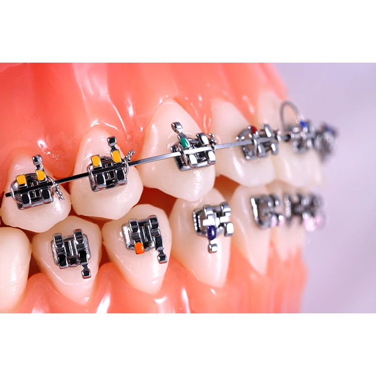 Wholesale Ortho Brackets Dental Mini Brackets Orthodontics Buy