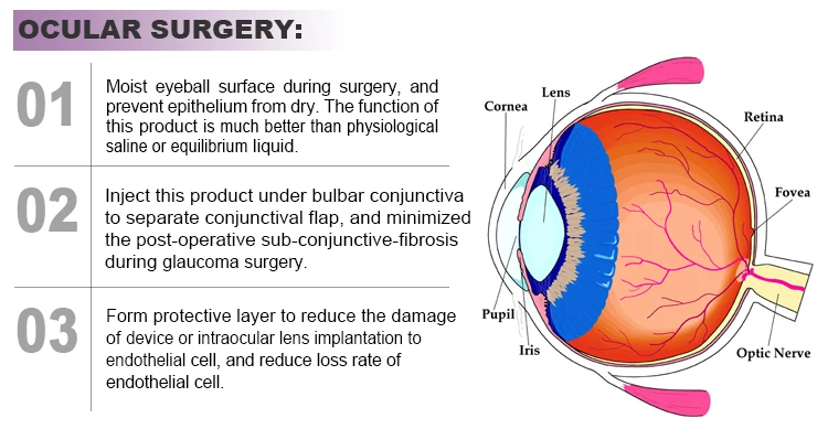 3毫升定制尺寸非交联身体透明质酸凝胶填料