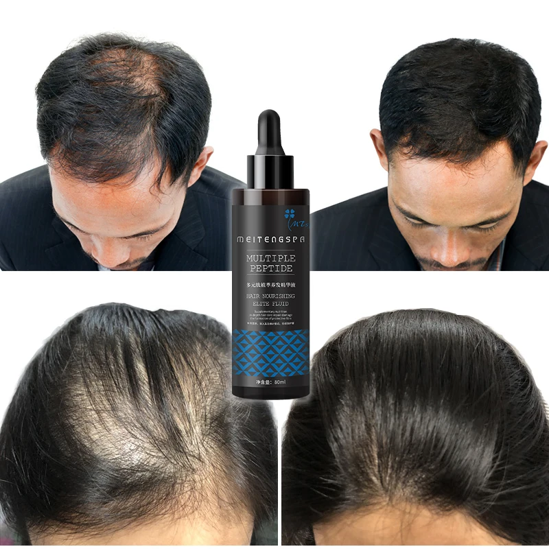 

Hair Regrowth Serum Anti hair loss treatment repair damage OEM/ODM private label hair tonic