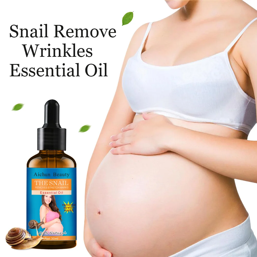 

OEM ODM Brand Organic Postpartum Stretch Mark oil Skin Repair Cream Body Pregnancy Scar Stretch Marks Removal Cream For Women