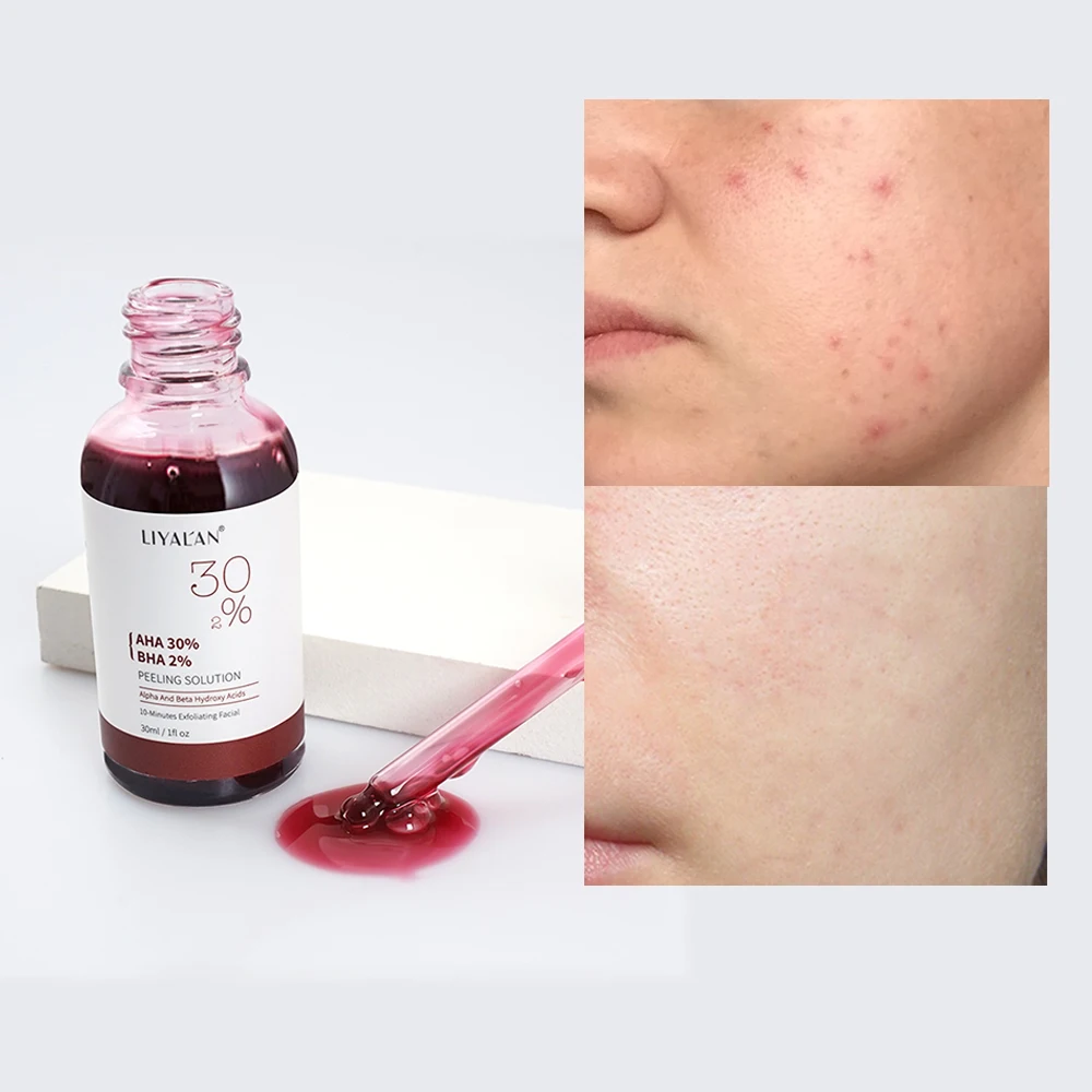 

Wholesale skin care 30ml vitamin c serum aha 30% bha 2% peeling solution face serum
