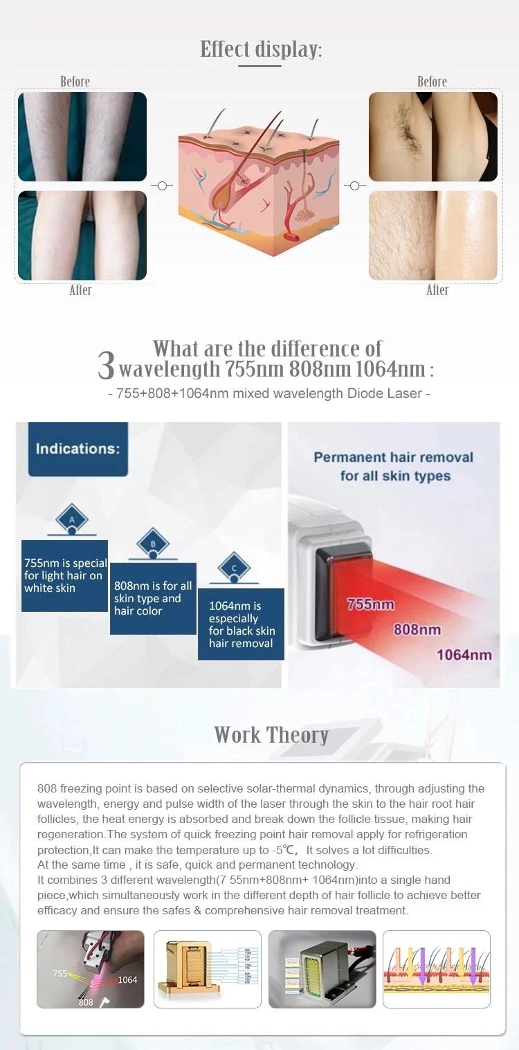 New design for wholesales 808 Professional 808nm diode laser hair