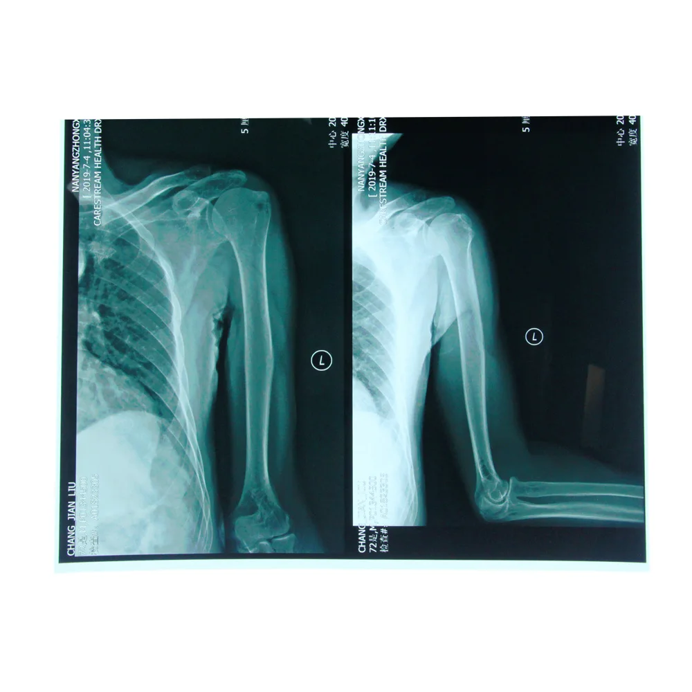 
PET based blue Fuji medical x-ray film laser X-Ray film 