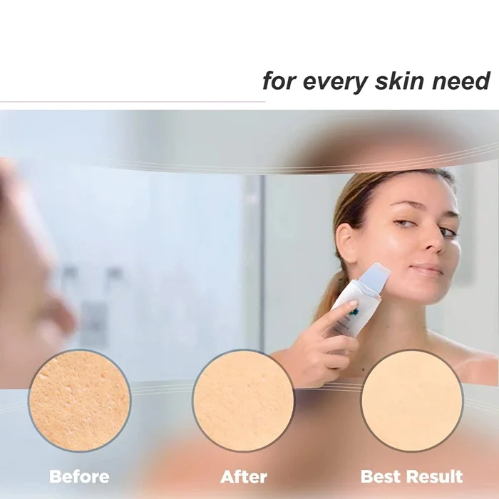 Facial Cleaning Shovel (2).jpg