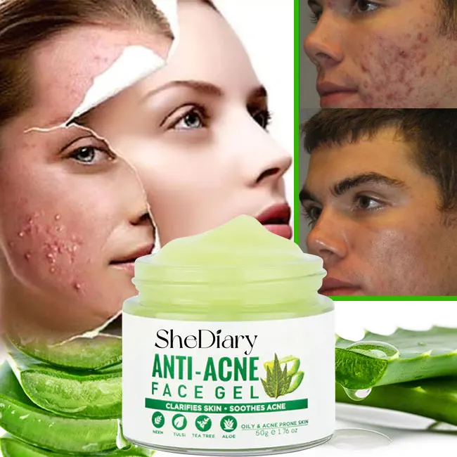 

custom logo 50g acne treatment aloe vera turmeric oil face creamaloe vera day creamface whitening aloe vera face cream