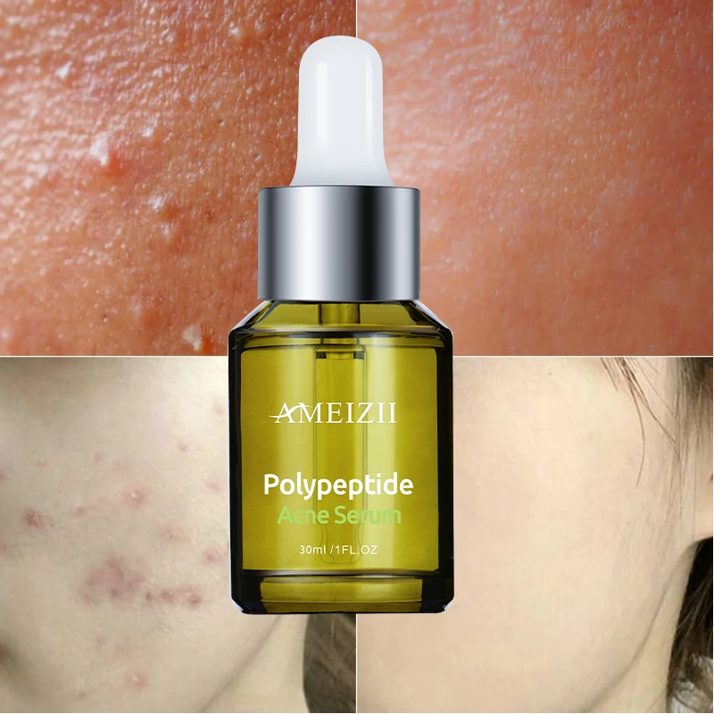 

OEM Herbal Plant Facial Serum Antibacterial Anti Acne Pimple Dark Spot Facial Serum Essence Skin Repairing Polypeptide Serum