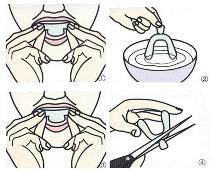 Teeth-Whitening (3).jpg