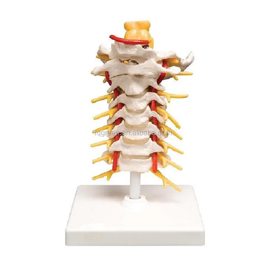 Lumbar Vertebrae Sacum With Nerves Model - Buy Lumbar Vertebra/ Nervi ...