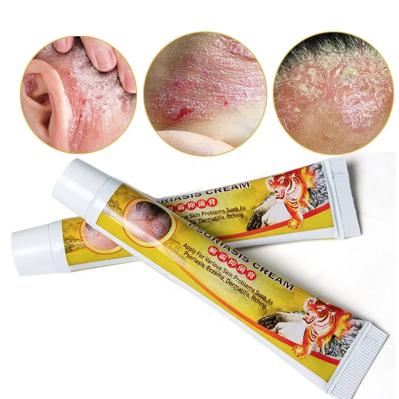 

Eczema cream psoriasis antiseptic dermatitis itching eczema-like herbal antipruritic ointment
