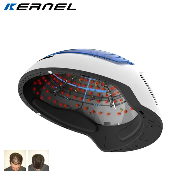 

CE approved hair growth laser diode Portable Laser Cap Thin Hair ReGrowth laser Helmet LLLT 650nm