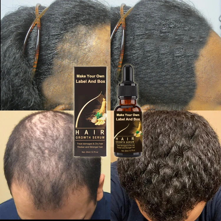 

OEM Natural Organic Natural Hair Care Anti Hair Loss Regrowth Scalp Elixirs Hair Growth Oil Serum