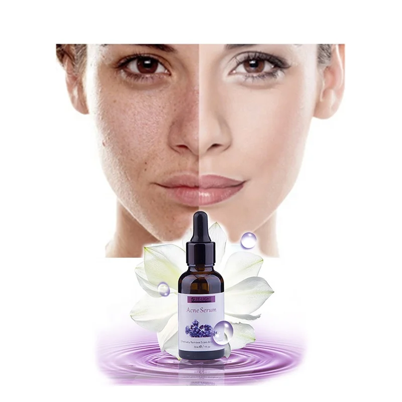 

VG Vitamin C Serum VC Removing Dark Spots Freckle Speckle Fade Ageless Skin Care Whitening Face Anti Winkles Anti-Aging, Transparent