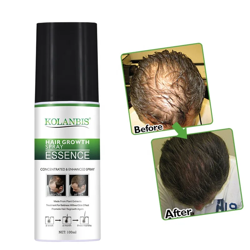 

OEM ODM High Quality Hair Building Spray Chinese Herbal Medicine Spray Hair Growth Supplement