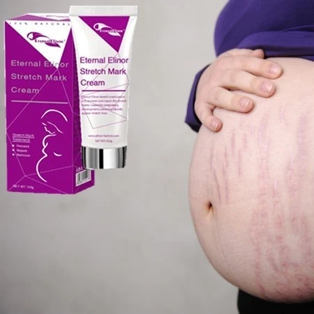 

High Quality Powerful Stretch Marks Remover Skin Repair Cream Treatment Scar Removal Pregnancy Cream