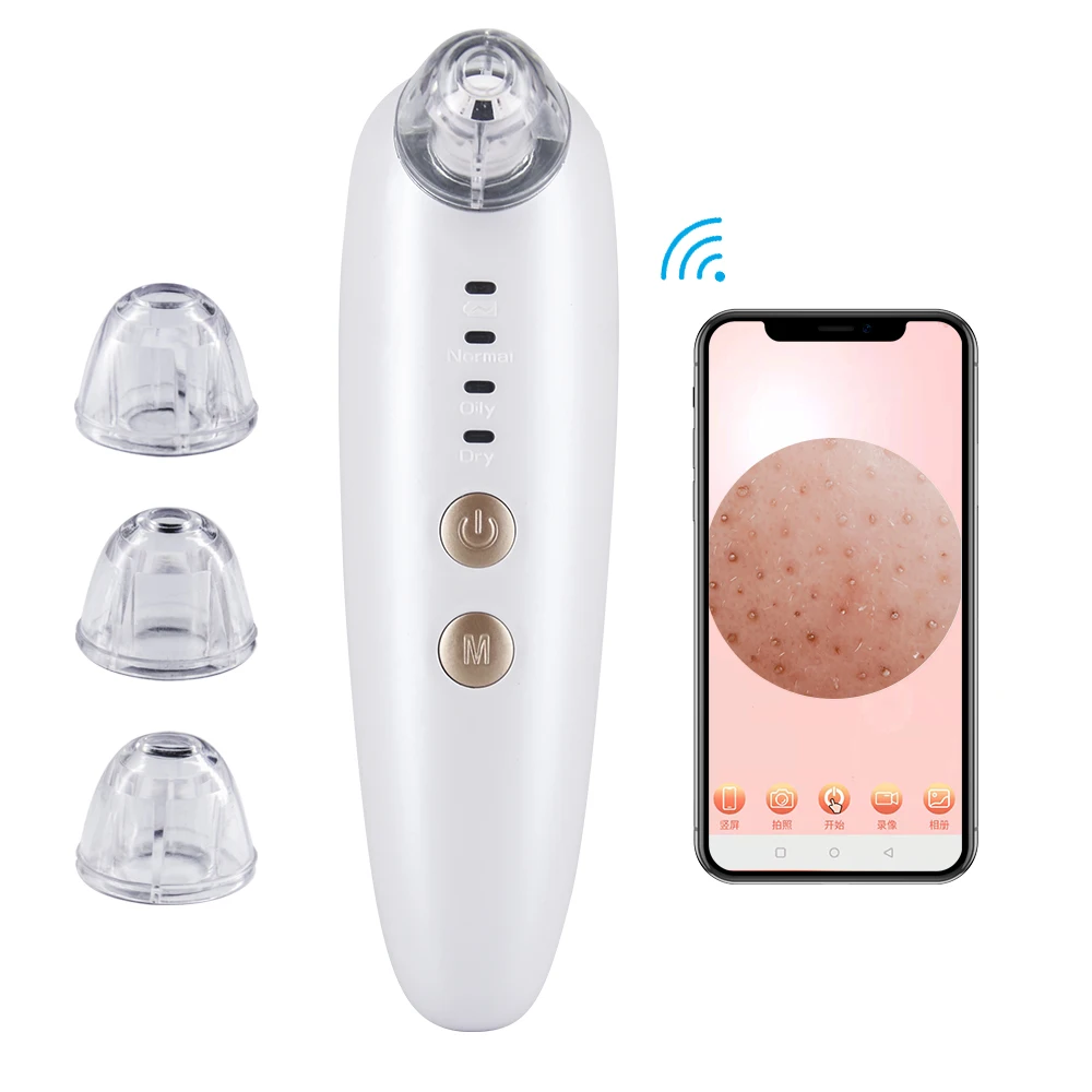 

USB rechargeable acen suction tool face black spot visual blackhead remover vacuum with camera, White