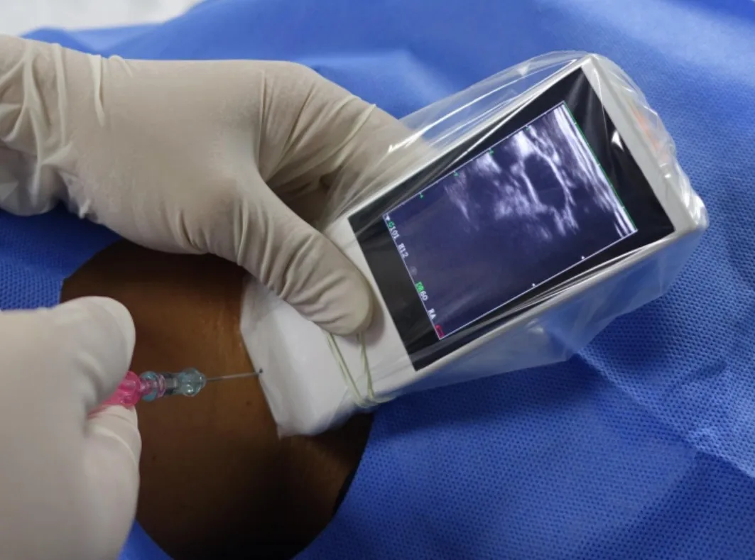 Visual Puncture Guidance Pocket Wireless Ultrasound Probe Buy Pocket