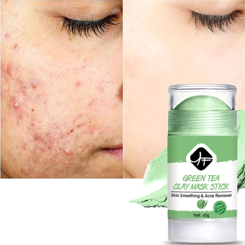 

OEM private logo beauty face skin care Blackhead Acne Removing natural clay green mask stick, Green/grey