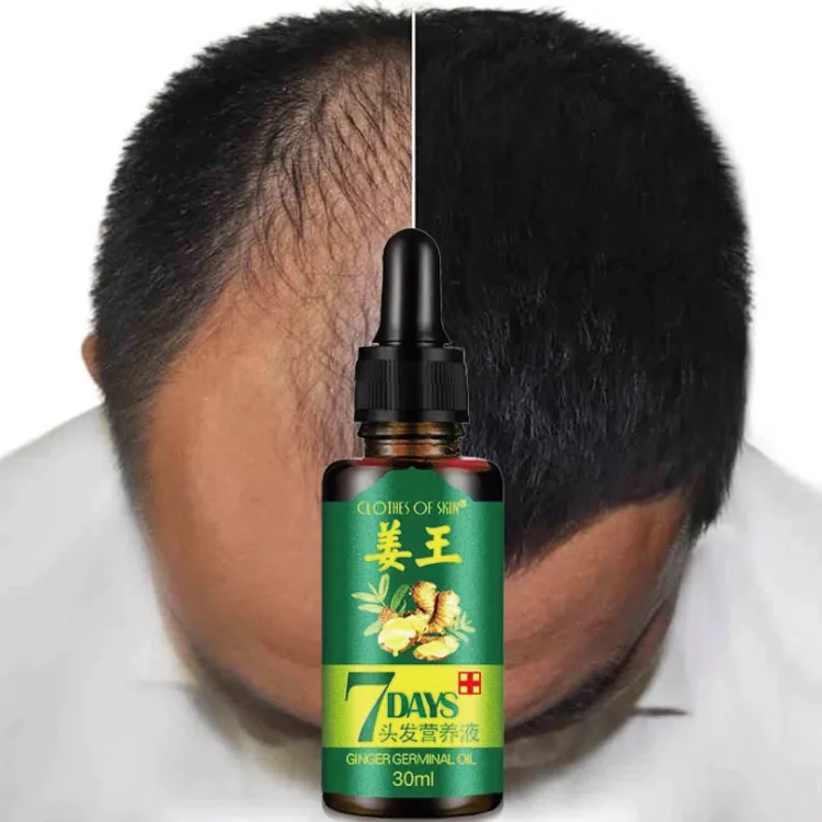 

Hair Loss Treatment Anti Balding Natural Remedies 30ML Ginger Germinal Oil Hair Growth Oil, Transparent liquid