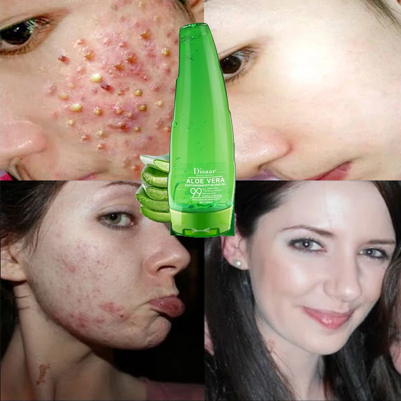 

Aloe Vera Gel Moisturizing, Moisturizing, Facial Revitalizing Moisturizing Gel