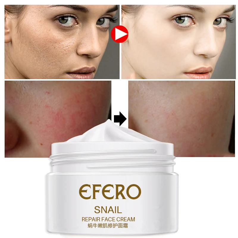 

Skin Care Anti Wrinkle Anti Aging Moisturizing Nutrition Repair Collagen Efero Snail Skin Whitening Face Cream
