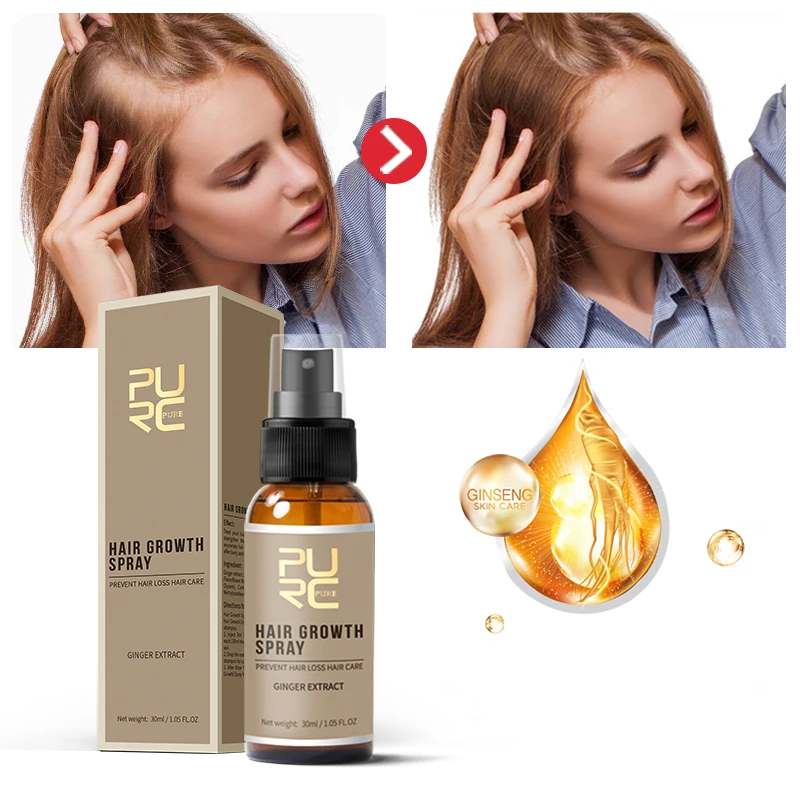 

Custom Private Label Anti Hair Loss Treatment Growth Oil Serum 30ML Organic Natural Ginger Germinal Regrowth Spray For Women Man