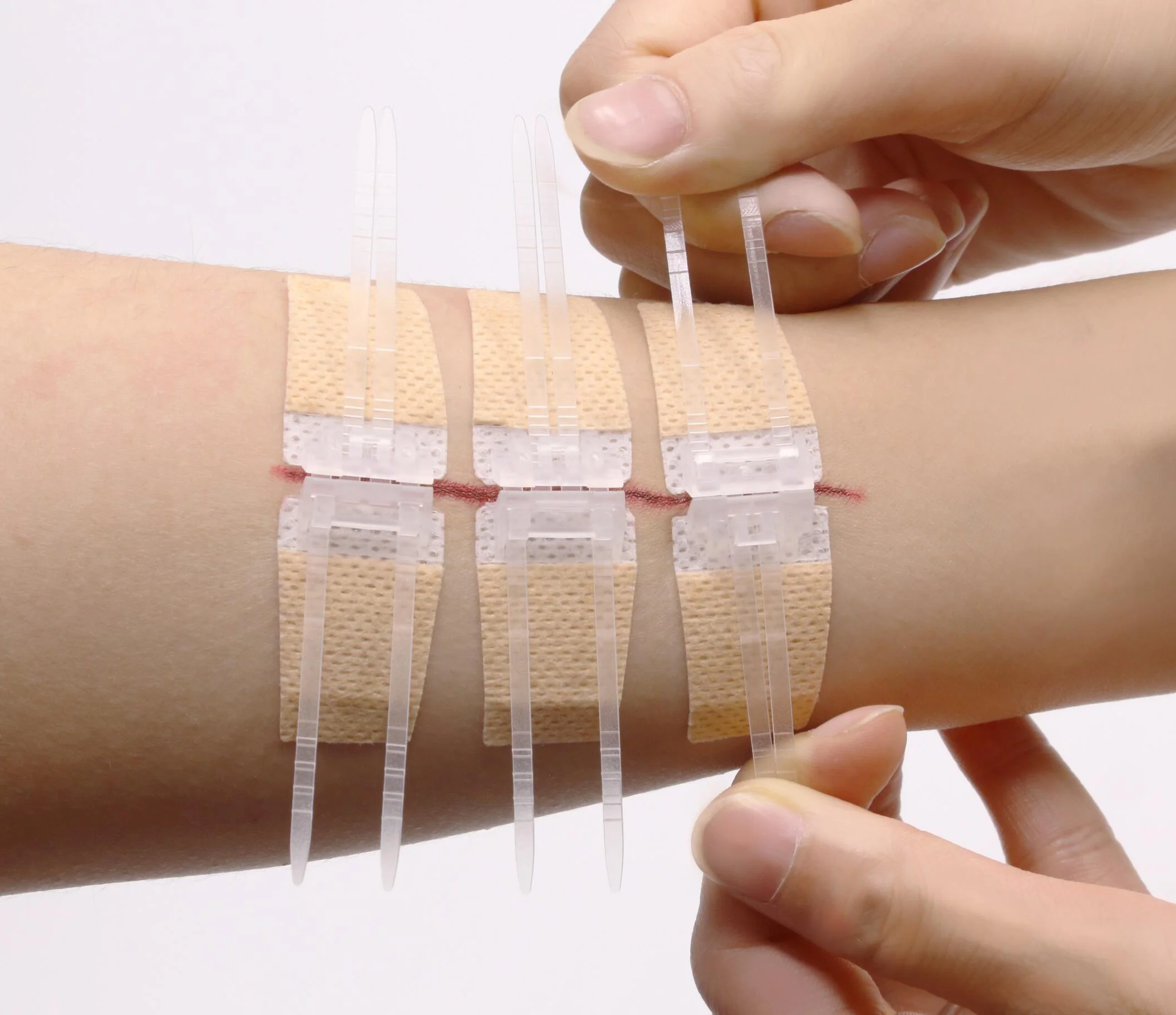 
ZipStitch Zip Stitch First Aid Emergency Kit Wound Closure Device No Thread And Needle Stitches PWF1001 